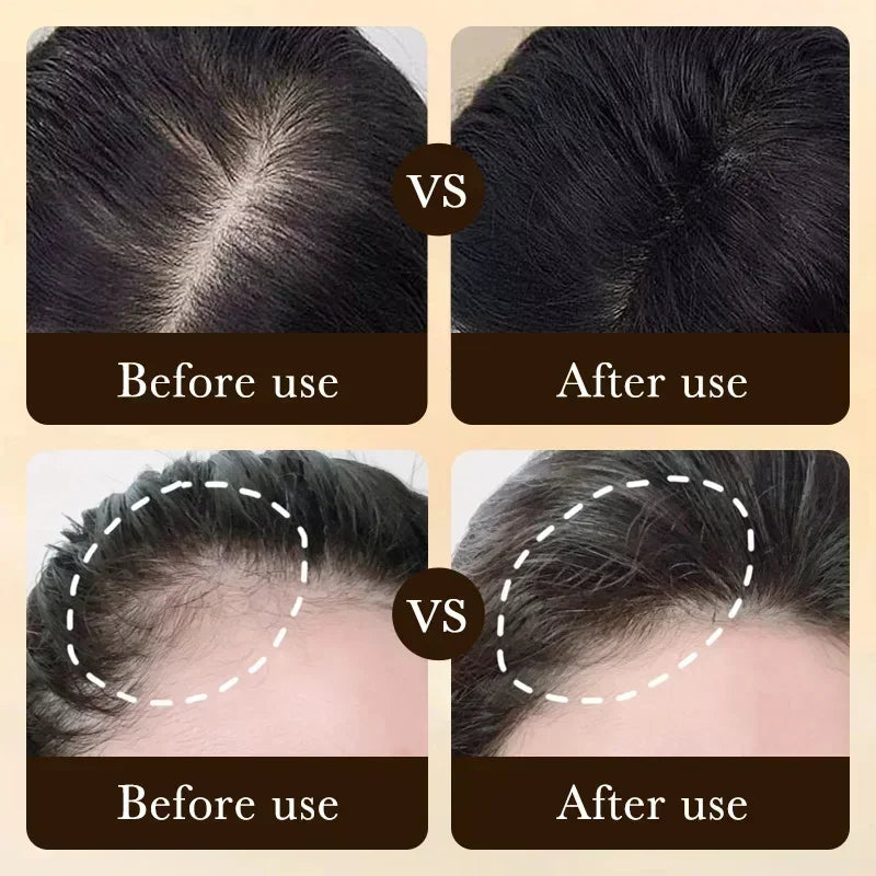 Rapid Regrow Biotin Serum + Scalp Massager